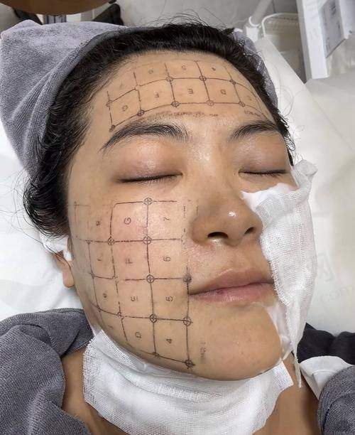 北京惠合嘉美医疗美容门诊部：该门诊部以优质的服务和专精的技术受到顾客的好评。在热玛吉治疗方面，门诊部的医生们有着丰富的临床经验。他们会根据顾客的年龄、肌肤状况和生活习惯等因素，综合考虑制定更适合顾客的热玛吉治疗方案。门诊部还注重与顾客的沟通，让顾客在治疗前充分了解热玛吉的原理、过程和成效，消除顾客的顾虑。同时，门诊部的环境舒适温馨，为顾客提供了一个良好的治疗体验。