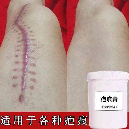 三、谷培俊医生的成功实例