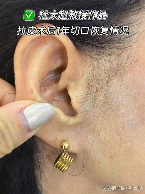 肖林医生详细介绍