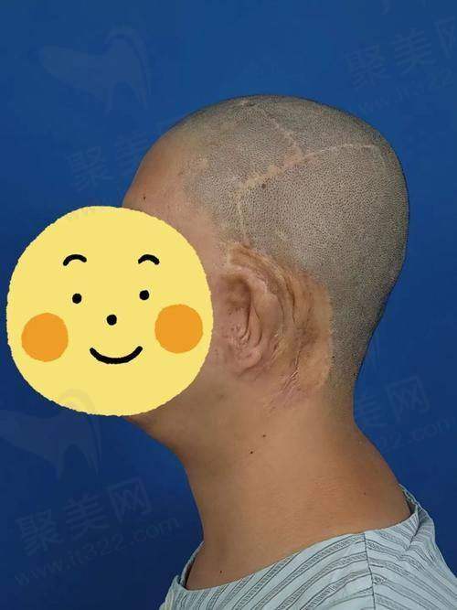四、沈阳耳朵整形医院的通用在线预约挂号快捷通道攻略
