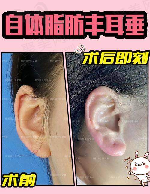 一、青岛人造耳朵哪里做比较好榜单前十名单