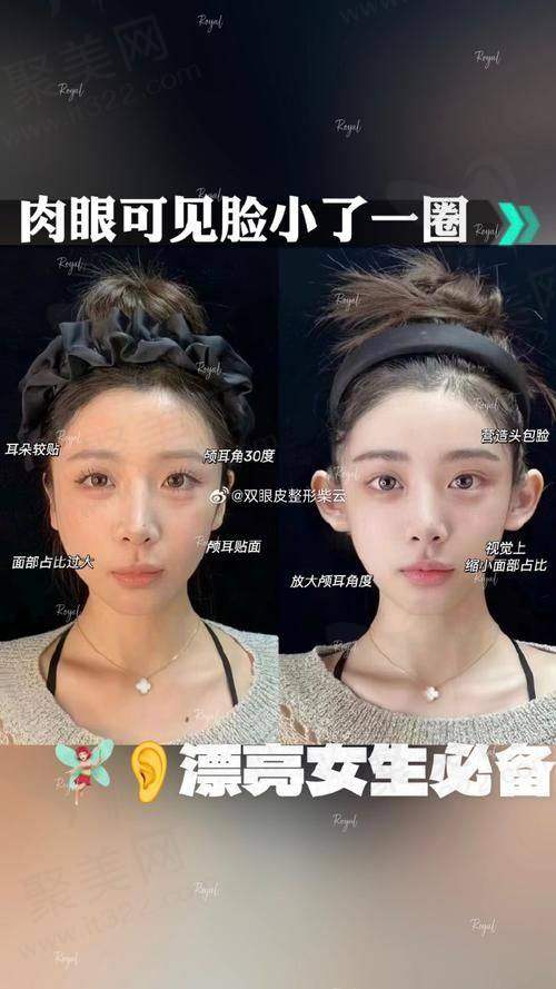 三、上海排名前五的耳朵修复医院收费价目表