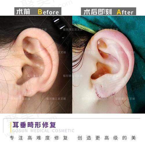 二、沈阳耳朵整形好的正规医院每家医院的详细介绍