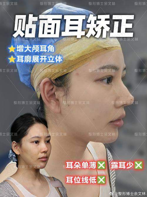 一、沈阳耳再造好的正规医院榜单前十名单