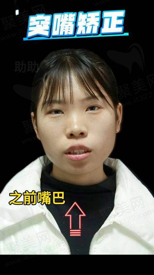肖林医生详细介绍