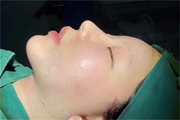 北京清木马梅生面部吸脂技术如何？价格3万起优势亮眼预约方式大公开