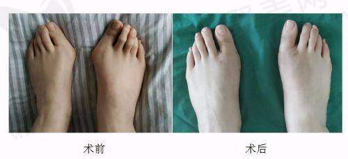 三、穆宝安 V 美减龄技术揭秘