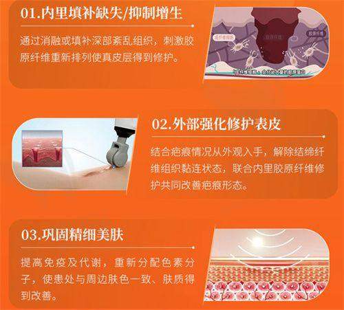 四、穆宝安拉皮手术优势
