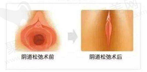 深圳国有医院整形科收费标准更新