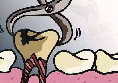二、呼和浩特华医口腔医院拔龋齿的技术特点