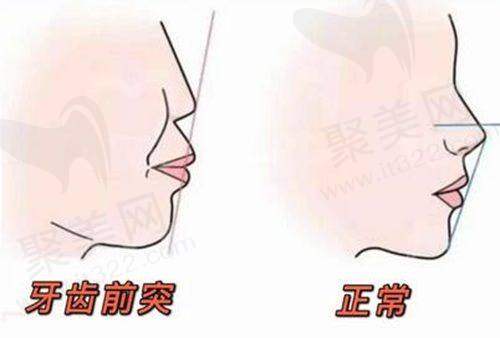 六、西安雅禾口腔牙友真实好评