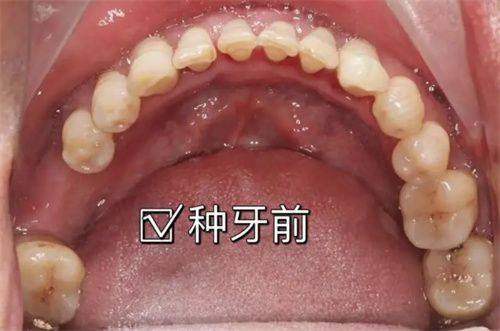 一、徐州市中 心医院口腔科：老牌劲旅，实力担当