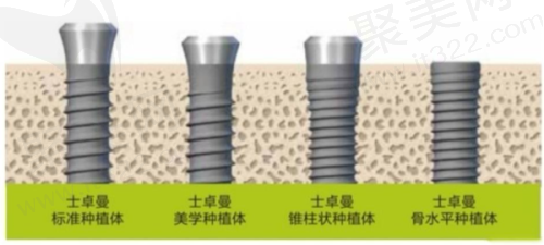 南宁诺贝尔口腔：医疗保险定点，优惠活动多