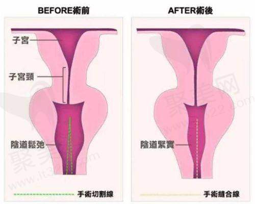 国内半岛超声炮官网认证机构名单及真伪辨别——重庆地区认证机构