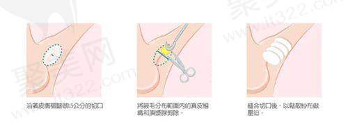 选择吕方中医生，收获美丽与安心