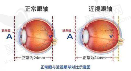 新疆乌鲁木齐美尼康眼科医院预约挂号流程