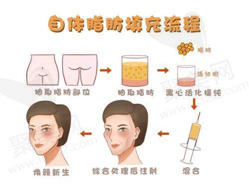 上海时光余东医生眼部整形怎么样？