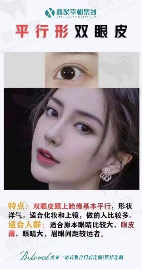 四、成都黄小林双眼皮修复实例