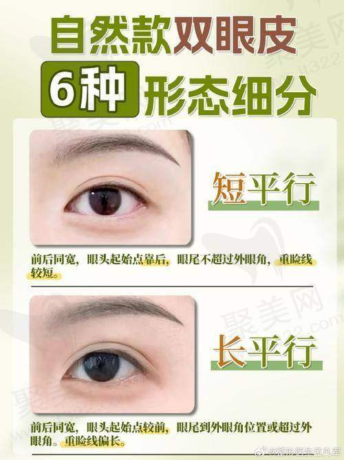 二、刘志刚眼修复费用多少