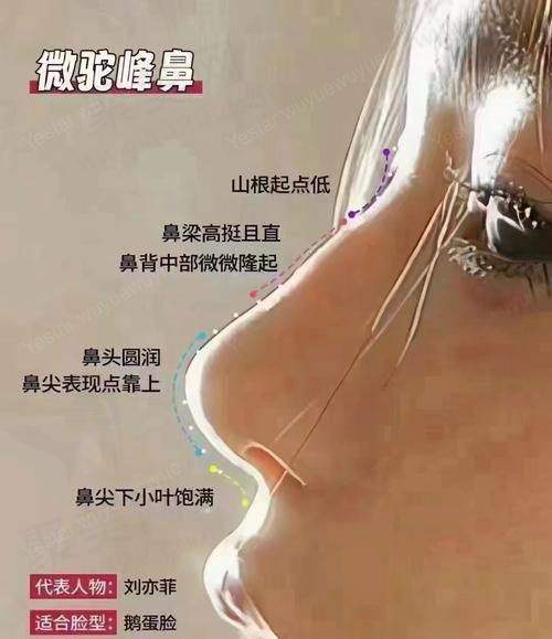 2、广州玻尿酸隆鼻价格表