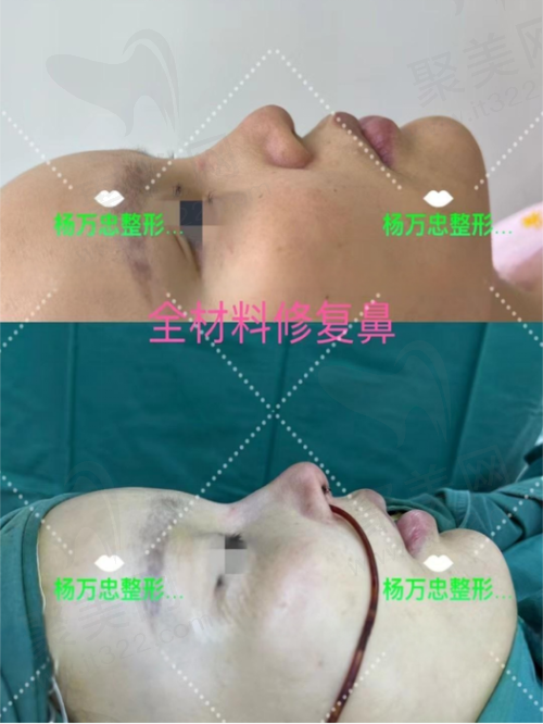 总结