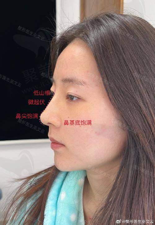 深圳鸿瑞医疗美容张辉医生顾客口碑评价