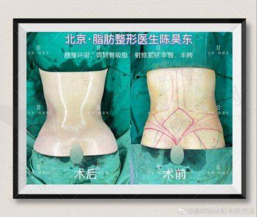 四、患者反馈与实例分享