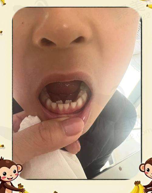 二、为何有人误以为成都医大口腔是国有