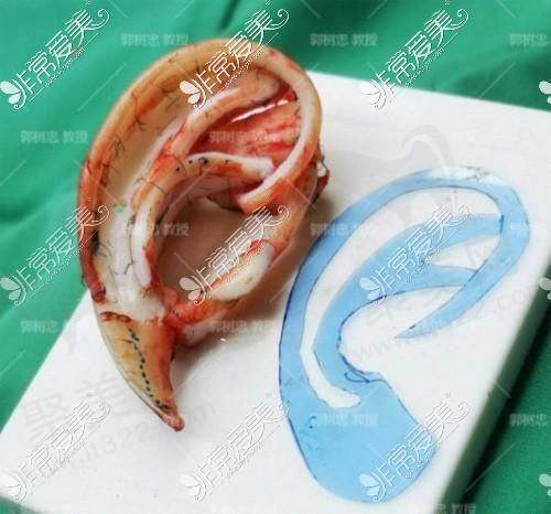 总结