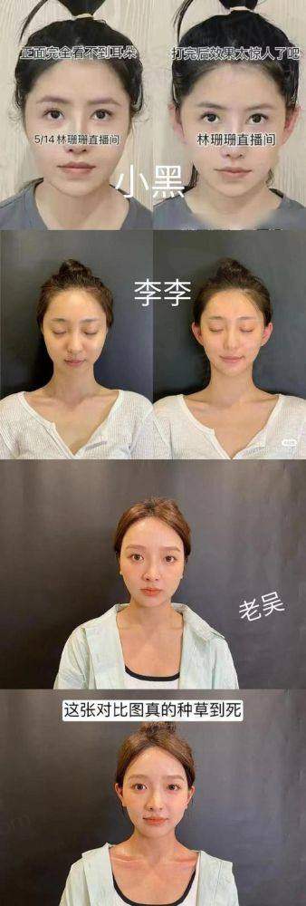 3. 佛山华美整形美容医院