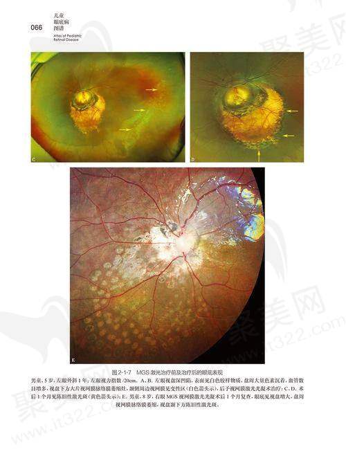 北京民众眼科医院齐越医生的真实的患者评价如下：
