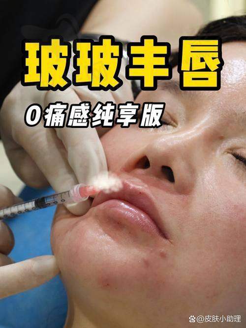 重庆艺星朱星蓉注射乔雅登丰颜XC玻尿酸11710元起，