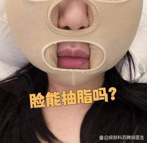 北京清木马梅生面部吸脂技术高超，含价格详情与电话、现场、网上预约方式