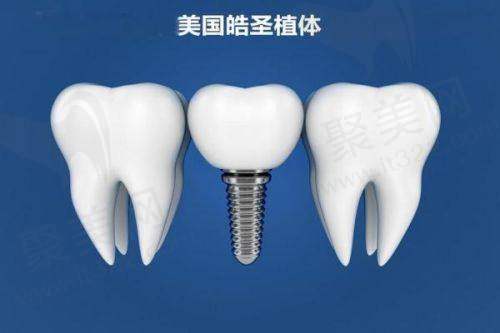 兰州星德口腔医院的收费价格优势