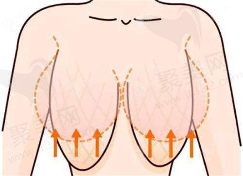 六、广州丽合医疗美容医院医生收费价目表,明细不少于8条