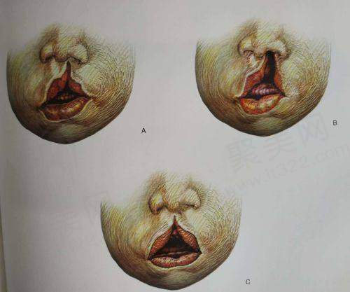 五、广州丽合医疗美容医院医生预约挂号攻略