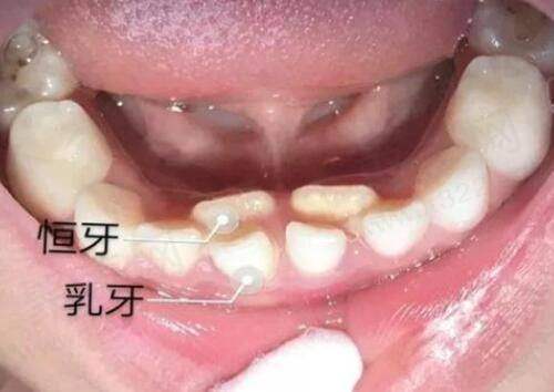 三、广州丽合医疗美容医院的口碑如何?集美们的实例评价