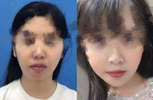 一、广州丽合医疗美容医院与广州曙光整形美容医院的基本资料与资质比较