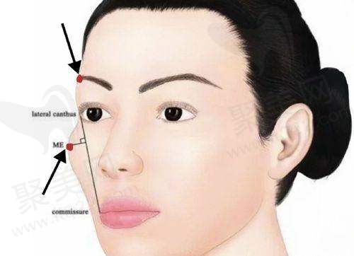 3. 隆胸整形价格