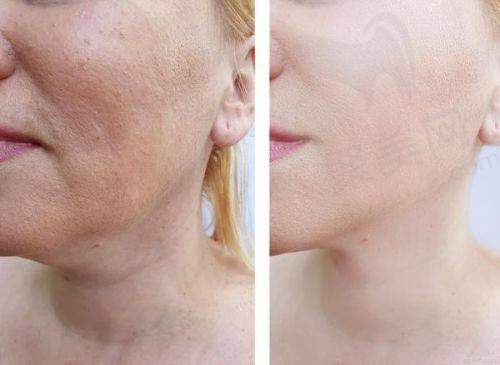 广州丽合医疗美容医院电话号码:地址、预约方式及交通路线全解析!