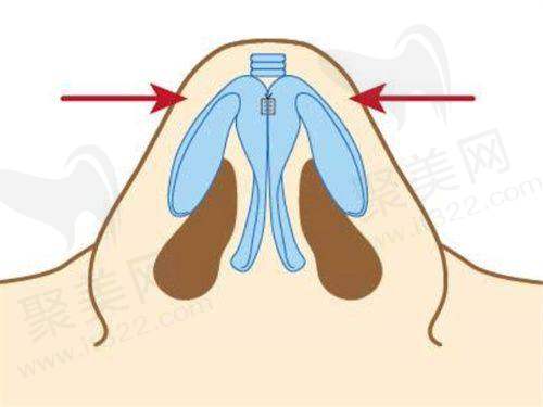 一、广州丽合医疗美容医院地址,详细展开介绍医院资料,资质、成就、和擅长项目等各个方面的内容
