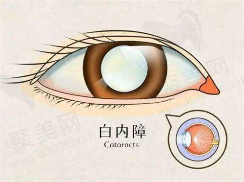 哈尔滨普瑞眼科医院韩清医生的真实的患者评价如下：