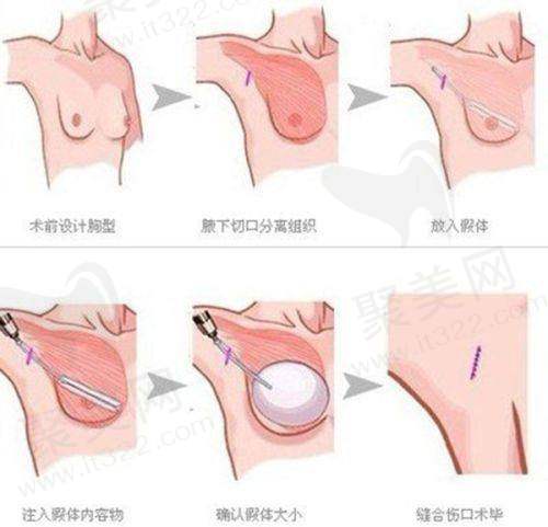 二、广州蜚称项目及技术优势