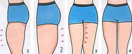 一、广州丽合医疗美容医院医生名单,详细展开介绍医院资料,资质、成就、和擅长项目等各个方面的内容