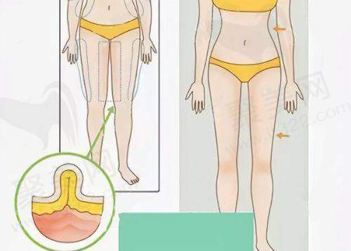 总结:广州丽合医疗美容医院的特色与优势