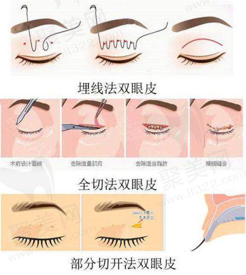 二、广州丽合医疗美容医院擅长项目解析