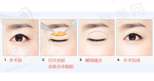 四、广州丽合医疗美容医院在哪里?详细介绍