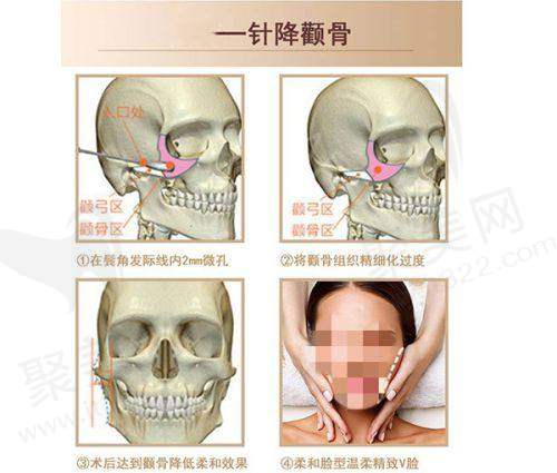广州丽合和艺星哪个好?医师团队、技术优势、患者反馈、医院环境、地理位置等多个方面对比分析