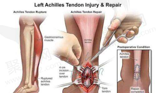 广州丽合医疗美容医院收费贵吗？鼻部、眼部、隆胸等整形项目价格一览，价格不贵费用合理！