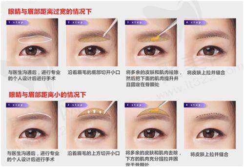 三、医院口碑如何?真实实例分享